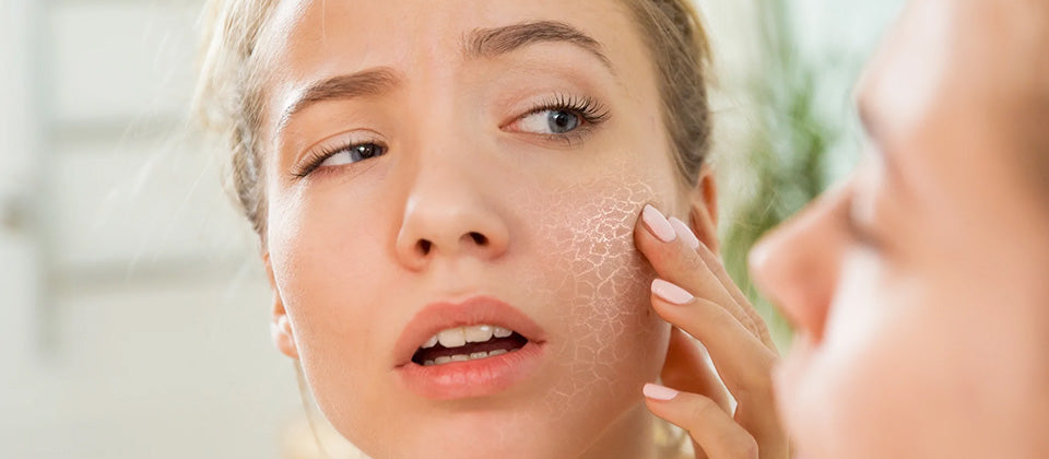 How to get rid of dry skin?