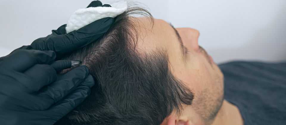 Useful tips to combat hair loss